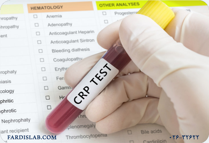 آیا CRP بالا به معنی عفونت است؟ آیا CRP بالا به معنی عفونت است؟
