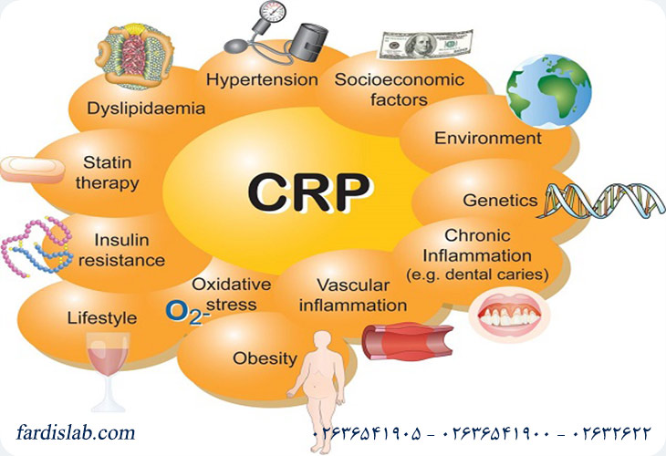 عوامل مؤثر در افزایش و کاهش سطح CRP