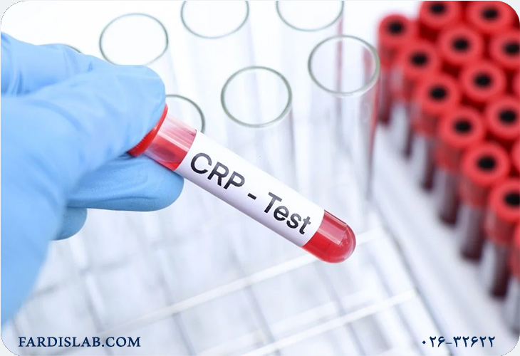 آیا CRP بالا با بیماریهای قلبی ارتباط دارد؟ آیا CRP بالا با بیماریهای قلبی ارتباط دارد؟