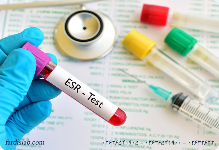ESR در آزمایش خون به چه معنا است؟