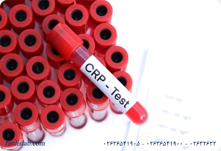 آزمایش crp