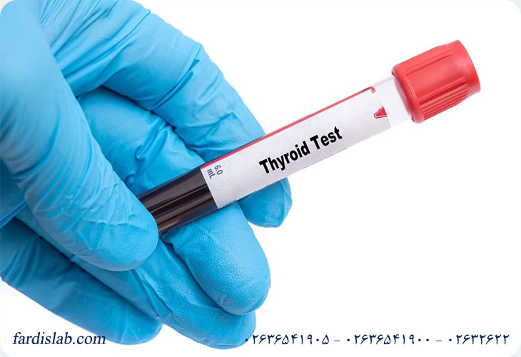 آزمایش Free T4 )T4 آزاد) چیست و چرا اهمیت دارد؟