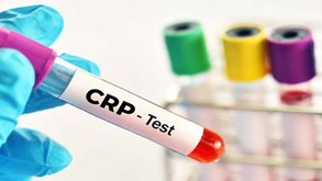آزمایش CRP چیست؟