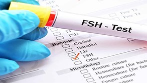 آزمایش fsh چیست؟