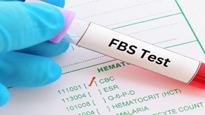 آزمایش fbs چیست؟