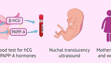غربالگری سه ماهه اول بارداری