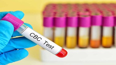 آزمایش CBC چیست؟