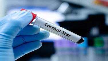 آزمایش کورتیزول چیست؟