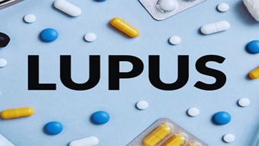 بیماری لوپوس چیست؟