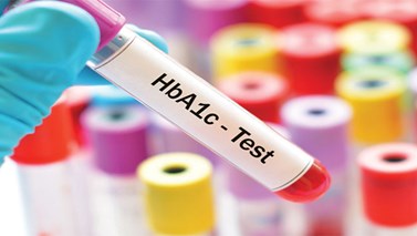 آزمایش HBA1C چیست؟