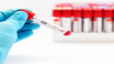 آزمایش CEA چیست؟