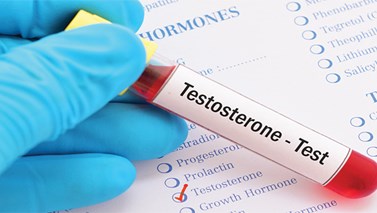 آزمایش تستوسترون