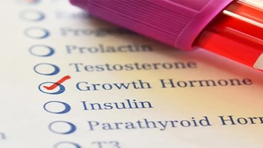 آزمایش هورمون رشد چیست؟