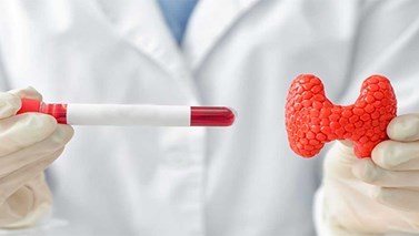 آزمایش t3 چیست؟