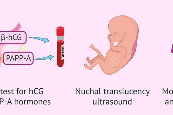 غربالگری سه ماهه اول بارداری