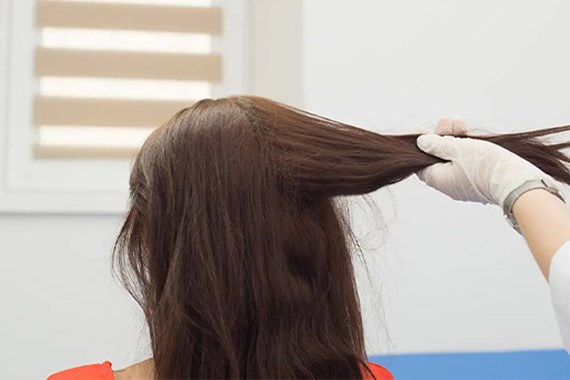 آزمایش ریزش مو؛ تشخیص علت ریزش مو در زنان و مردان