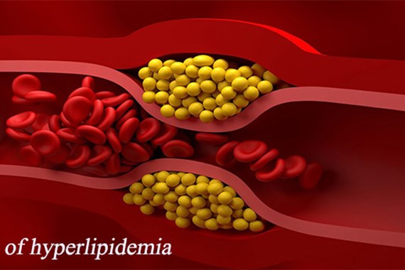 علائم چربی خون بالا چیست؟