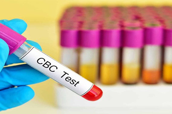 آزمایش CBC چیست؟