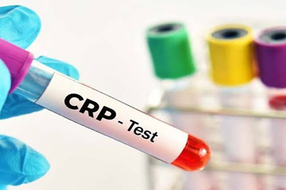 آزمایش CRP چیست؟