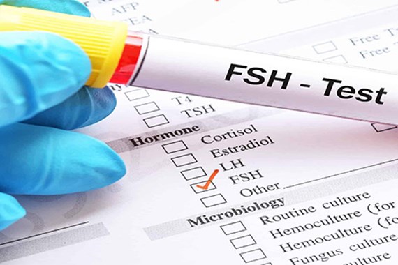 آزمایش fsh چیست؟