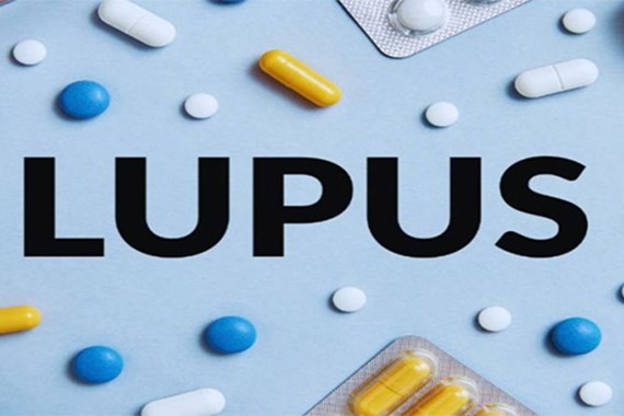 بیماری لوپوس چیست؟