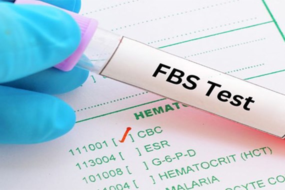 آزمایش fbs چیست؟