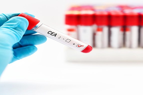 آزمایش CEA چیست؟