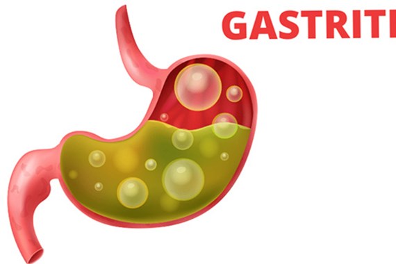 روش های درمان و تشخیص ورم معده