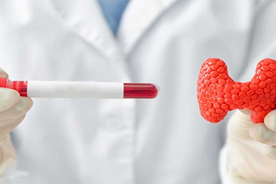 آزمایش t3 چیست؟