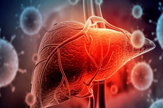 هپاتیت (Hepatitis) چیست؟