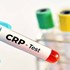 آزمایش CRP چیست؟