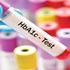 آزمایش HBA1C چیست؟