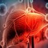 هپاتیت (Hepatitis) چیست؟