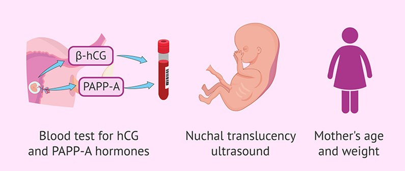 غربالگری سه ماهه اول بارداری