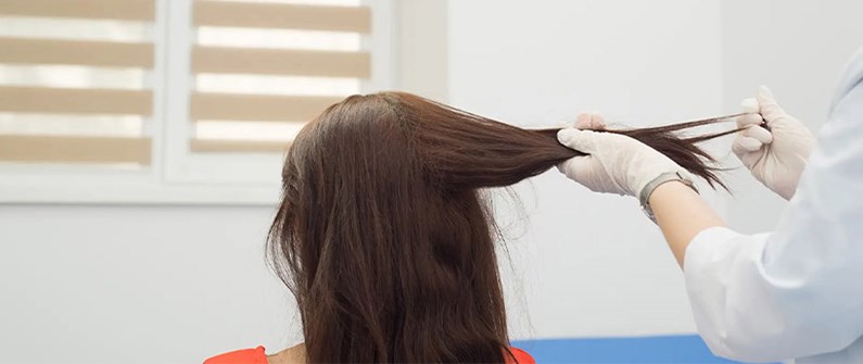 آزمایش ریزش مو؛ تشخیص علت ریزش مو در زنان و مردان