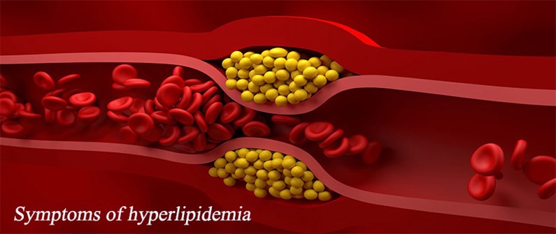 علائم چربی خون بالا چیست؟
