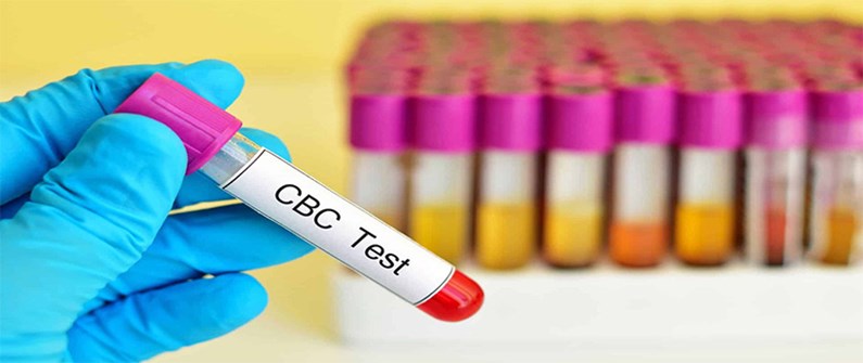 آزمایش CBC چیست؟