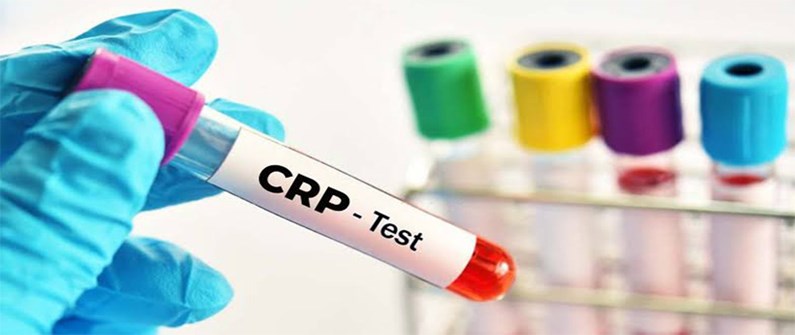 آزمایش CRP چیست؟