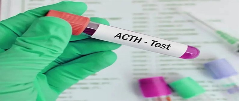 آزمایش ACTH چیست؟