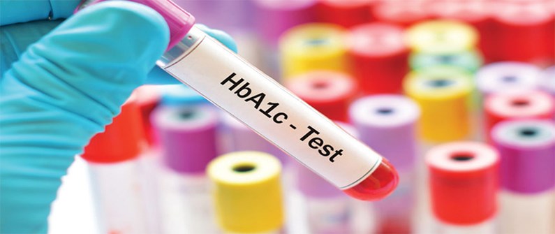 آزمایش HBA1C چیست؟