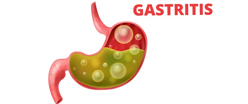 روش های درمان و تشخیص ورم معده